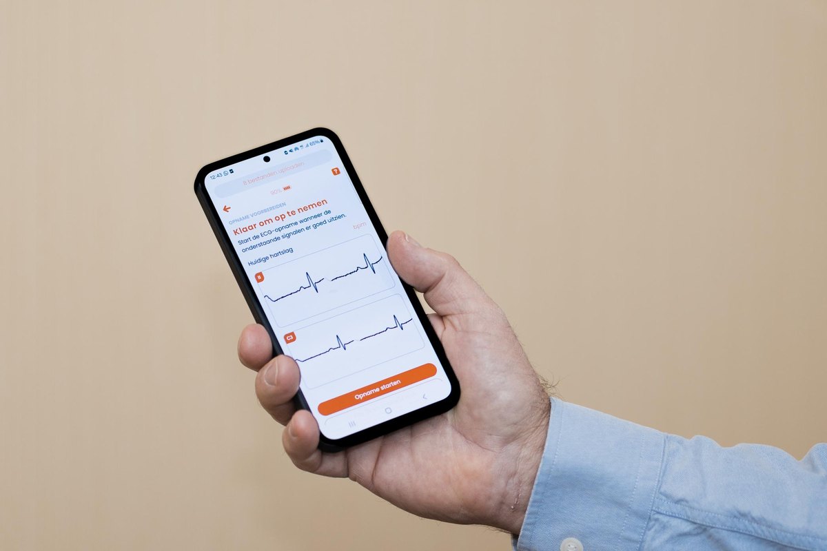 A hand holding a smartphone showing an ECG recording in the HeartEye app.