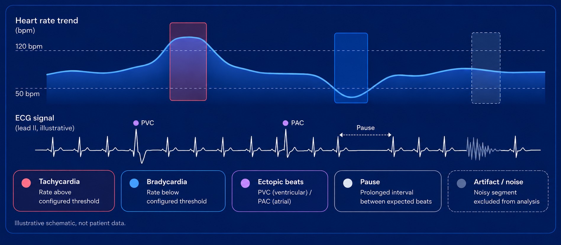 Illustrative Holter schematic: heart-rate trend with tachycardia, bradycardia and noise segments above an ECG signal marking a PVC, a PAC, a pause and an artifact, with a legend for tachycardia, bradycardia, ectopic beats, pause and artifact or noise.